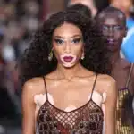 Winnie Harlow