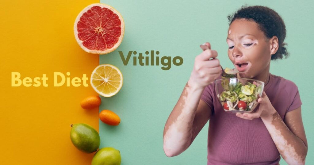 Best Diet for Vitiligo Patients