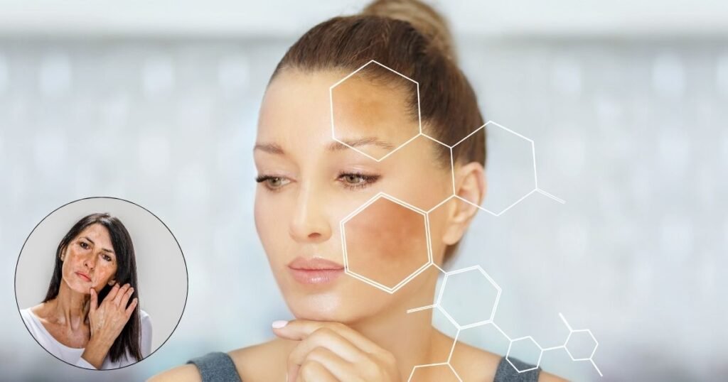 Best way to Increase Melanin in Skin for Vitiligo Naturally?