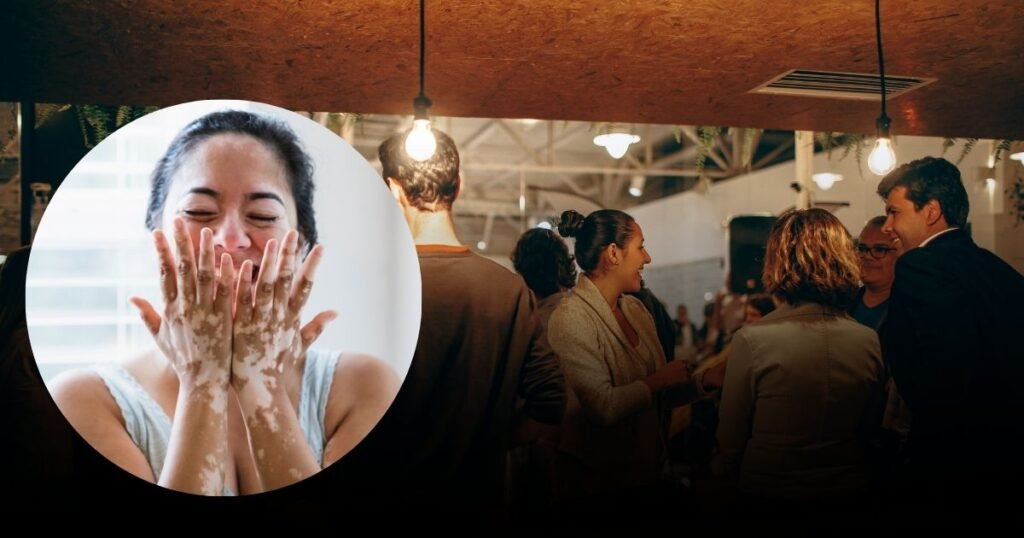 How Does Vitiligo Affect Quality of Life?