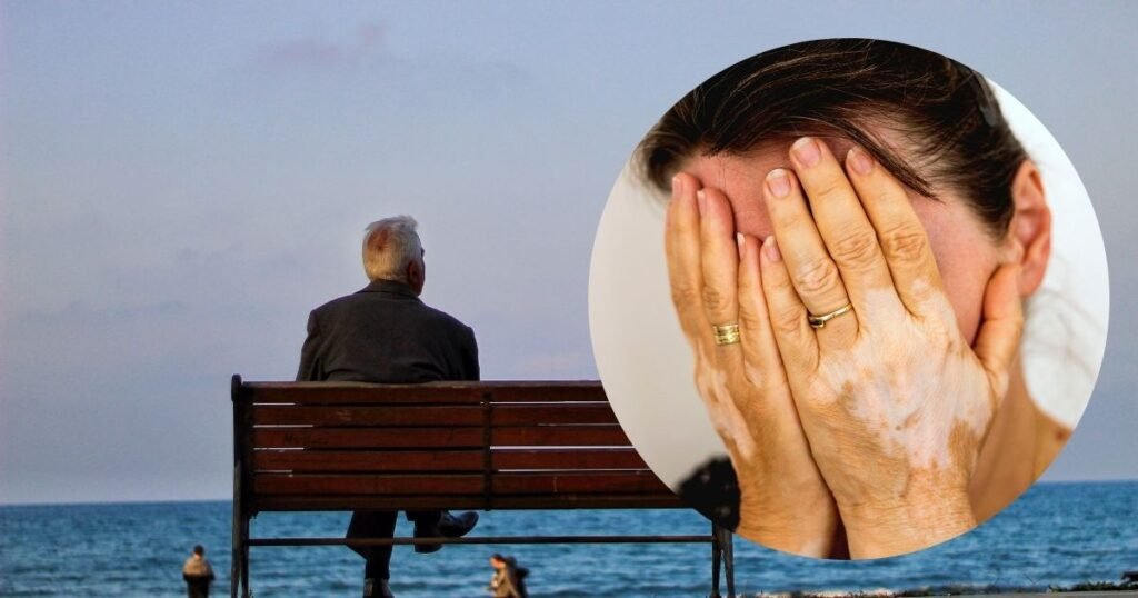 What Causes Vitiligo Later in Life