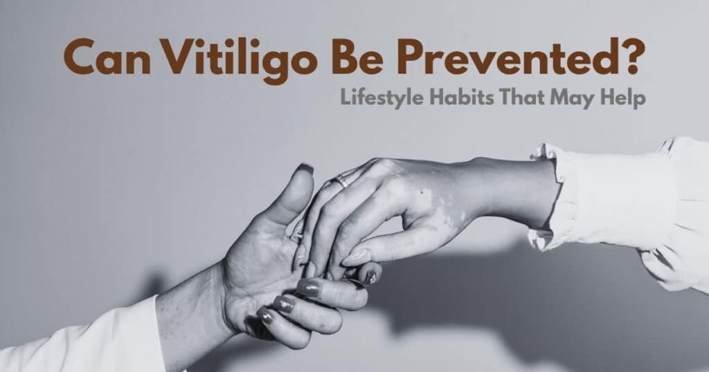 Can Vitiligo Be Prevented? Lifestyle Habits That May Help