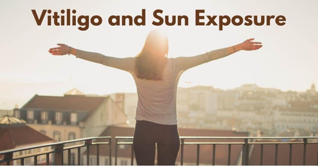 Vitiligo and Sun Exposure: Do's and Don’ts